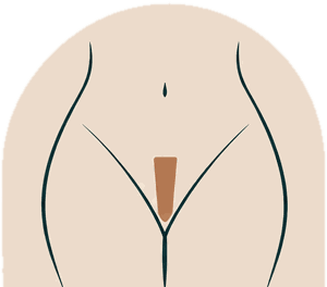 G-string wax illustration: a 3 to 4 finger width strip of hair left