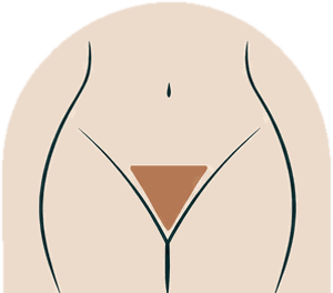 Extended bikini wax illustration: a smaller triangle of hair left at the front