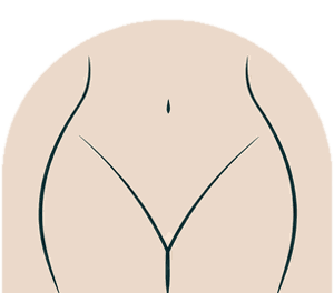 Hollywood wax illustration: completely hair free